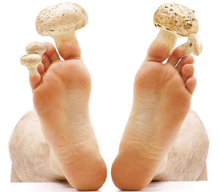 Mushrooms on feet and nails