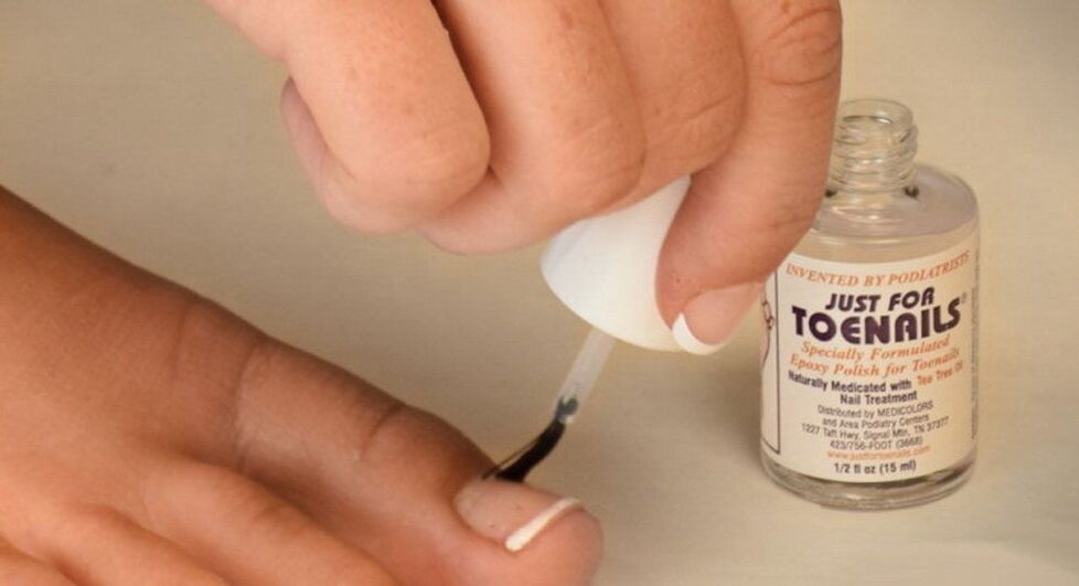 nail polish fungus on the big toe