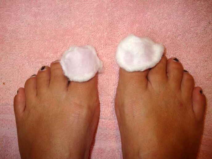 lotions against mushrooms on the feet