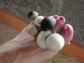 mushrooms between the toes