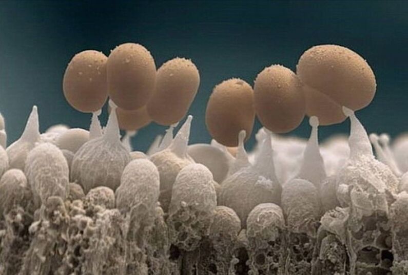nail fungus under the microscope