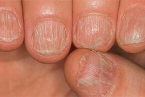 The mushroom injury