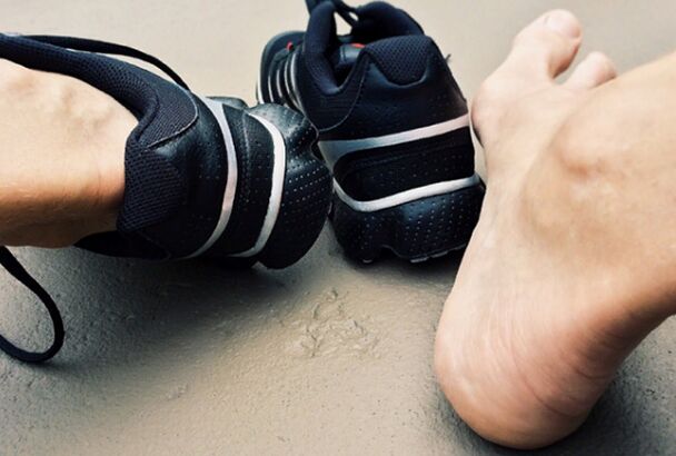 Causes of the appearance of mycosis of the legs