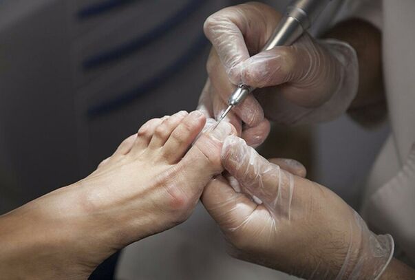 Diagnosis of the feet of the legs