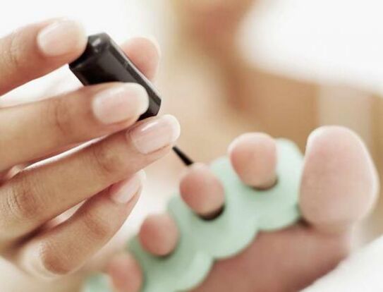 nail treatment with nail varnish in case of fungal infection