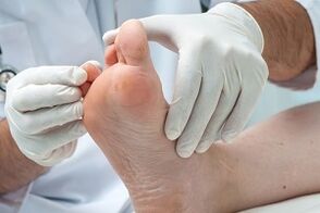 a doctor examines the foot to see if there is any fungus on the toes