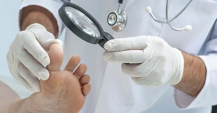 the doctor examines the foot against nail fungus