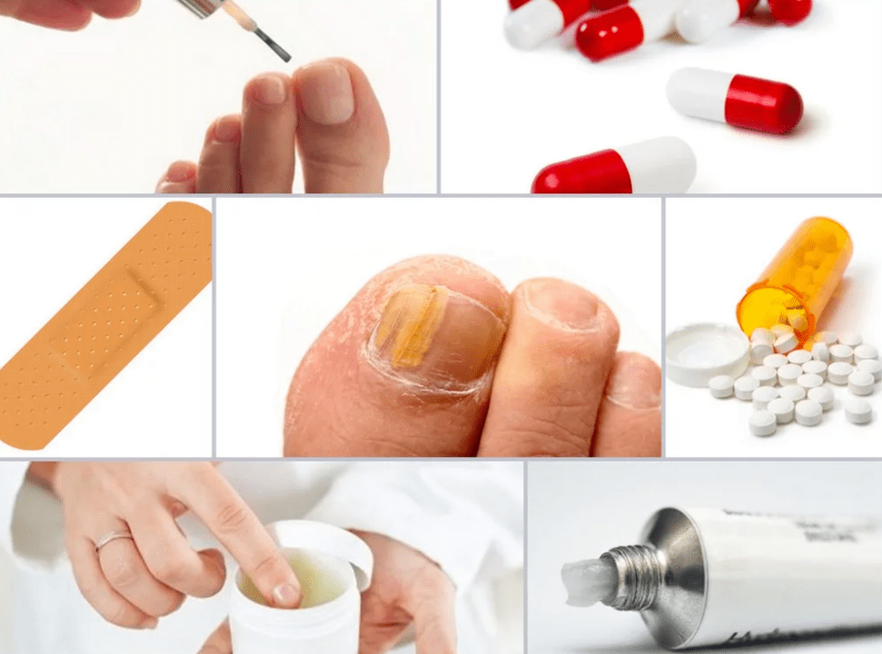 systemic drugs against nail fungus