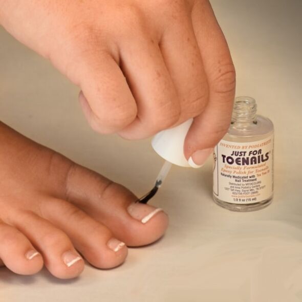 fungal varnish is applied in the early stages of nail fungal infection
