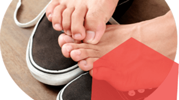 itchy skin on the feet, symptoms of a fungal infection